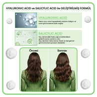 MORFOSE MORFOSE MORFOSE METAMORFOSE ARINDIRICI ŞAMPUAN 10ML 1 of 6