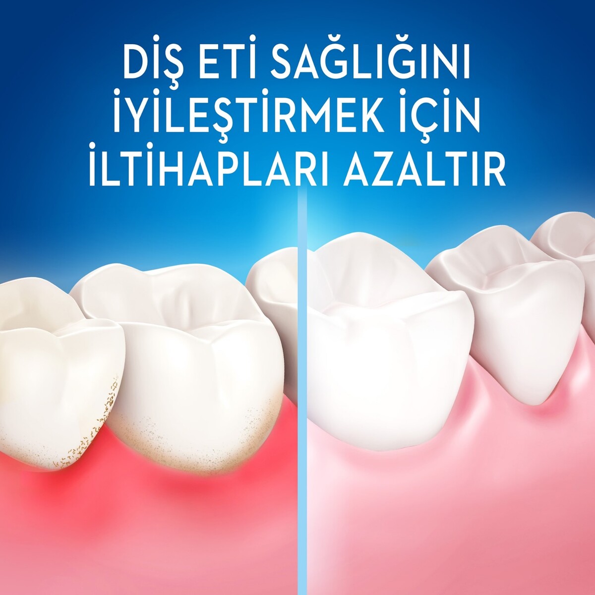  ORAL-B ORAL-B Oral-B Complete 5 Yönlü Temizlik Diş Fırçası  1 of 5 