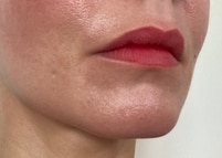 BP_1376795_enhance_review_media_9371561983