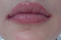 BP_1391579_enhance_review_media_2064001974 BP_1391579_enhance_review_media_2064001974