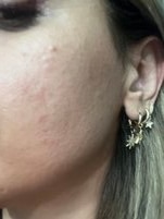 BP_1461530_enhance_review_media_4599497497 BP_1461530_enhance_review_media_4599497497